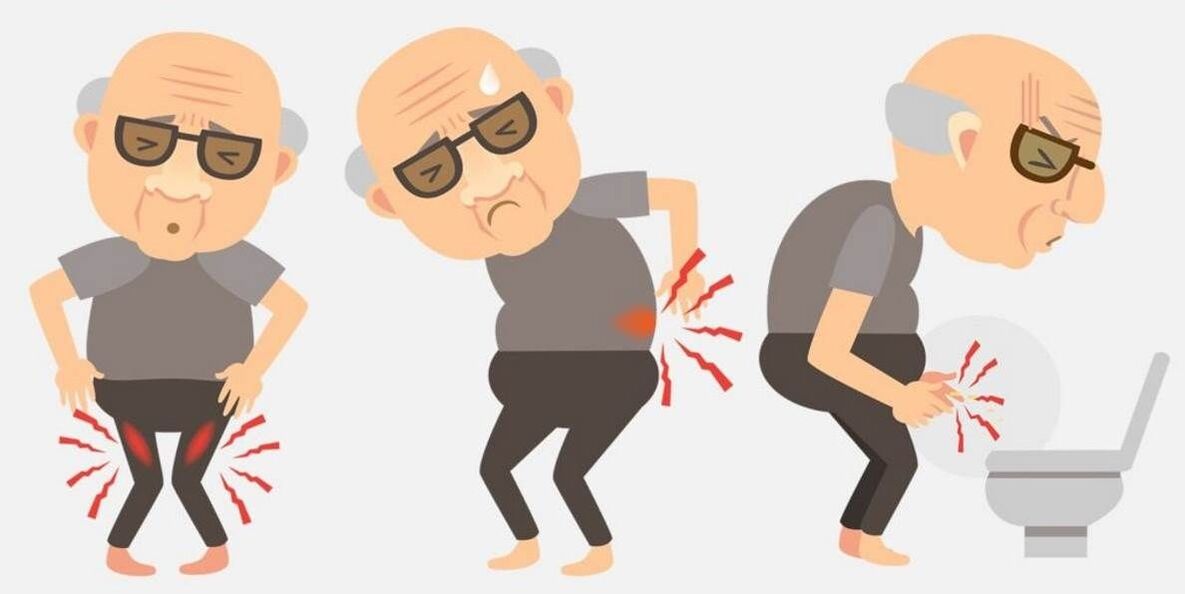 prostatiidi sümptomid